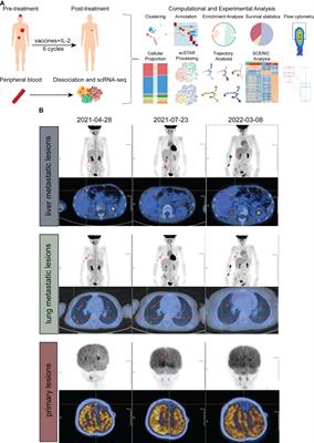 Single-cell analyses reveal the therapeutic effects of ATHENA and its mechanism in a rhabdomyosarcoma patient